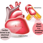 The Information about the Differences of the Cardiac Arrest VS Heart Attack Disease
